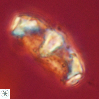 Gorkaea pseudanthophorus VR 22678