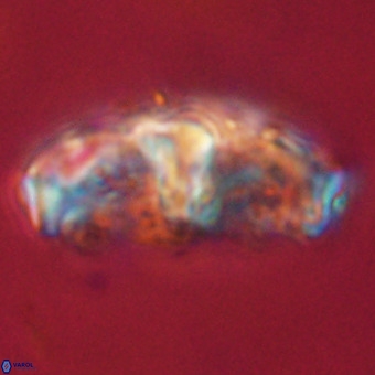 Gorkaea pseudanthophorus VR 22683