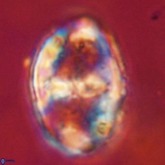 Gorkaea pseudanthophorus VR 22697