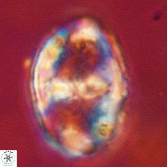 Gorkaea pseudanthophorus VR 22697
