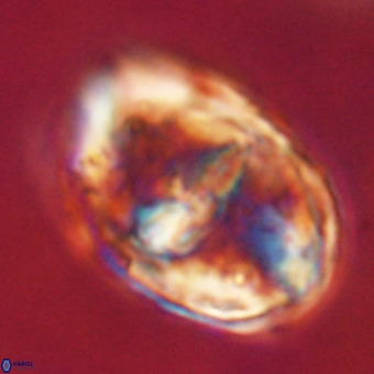 Gorkaea pseudanthophorus VR 22700