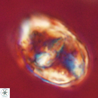 Gorkaea pseudanthophorus VR 22700