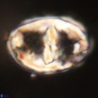 Gorkaea pseudanthophorus VR 22701