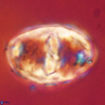 Gorkaea pseudanthophorus VR 22702