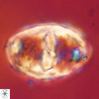 Gorkaea pseudanthophorus VR 22702