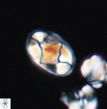 Gorkaea rhombocclusa 11347