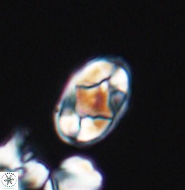 Gorkaea rhombocclusa 11351