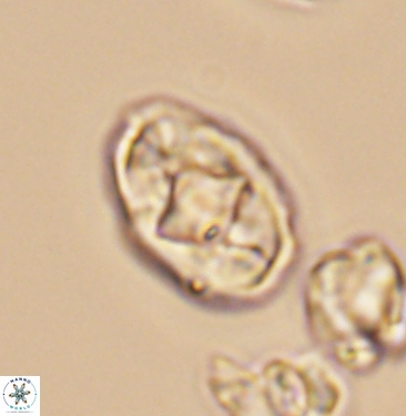 Gorkaea rhombocclusa 11355