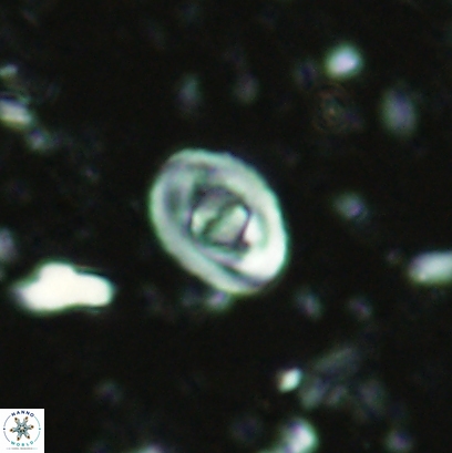 Glaukolithus bicrescenticus 4544