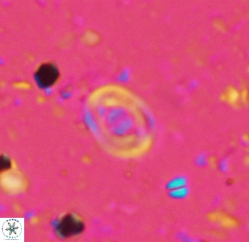 Glaukolithus bicrescenticus 4801