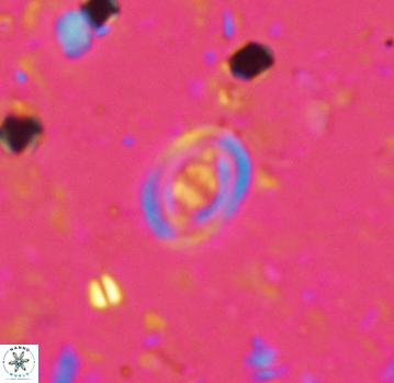 Glaukolithus bicrescenticus 4805