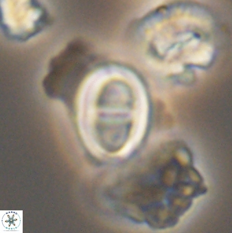 Glaukolithus diplogrammus 09138