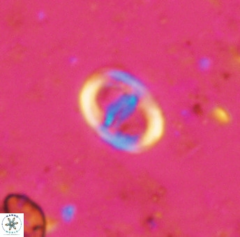 Glaukolithus diplogrammus 42420