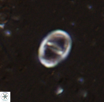 Glaukolithus diplogrammus 42421