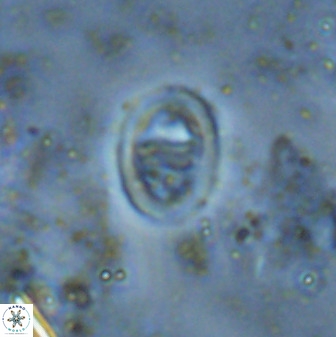 Glaukolithus diplogrammus 42423