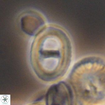 Glaukolithus diplogrammus 8735