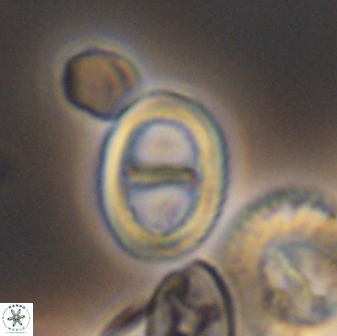 Glaukolithus diplogrammus 8736