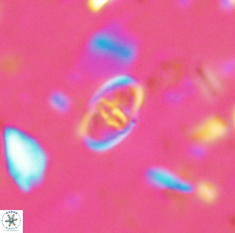 Glaukolithus fissus 33229
