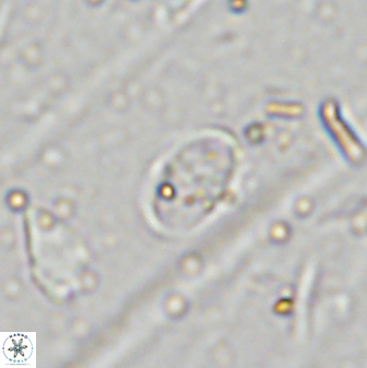Glaukolithus fissus 33230