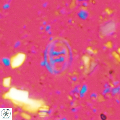 Glaukolithus mediotenebris 04522