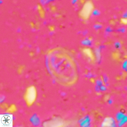 Glaukolithus mediotenebris 04524