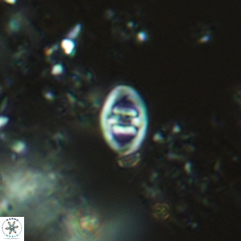 Glaukolithus mediotripartitus 05570