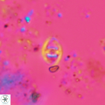Glaukolithus mediotripartitus 05571