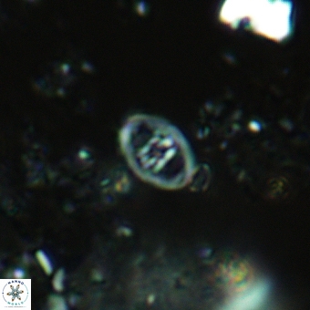 Glaukolithus mediotripartitus 05572