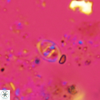 Glaukolithus mediotripartitus 05573