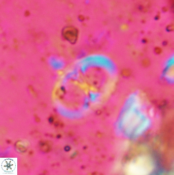 Glaukolithus papilionaceus 05522