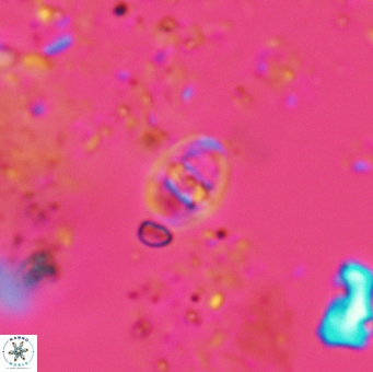 Glaukolithus trespontis 5575