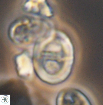 Glaukolithus trichotrichus 08498