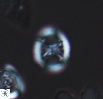 Grantarhabdus meddii 10711
