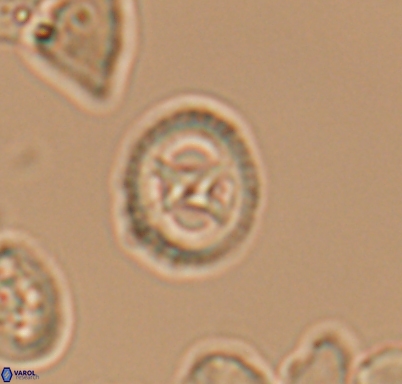 Grantarhabdus meddii 10715