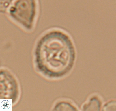 Grantarhabdus meddii 10715