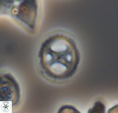 Grantarhabdus meddii 10716