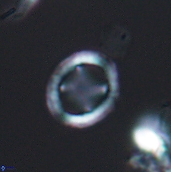 Grantarhabdus meddii 12833