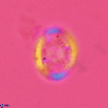 Grantarhabdus meddii 3608