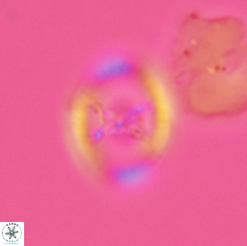 Grantarhabdus meddii 3616