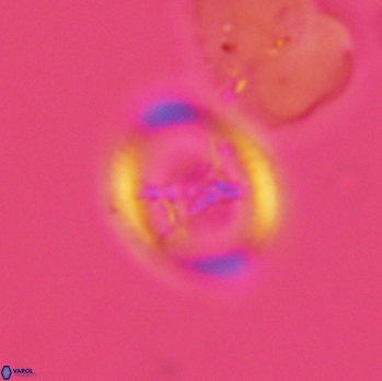 Grantarhabdus meddii 3617