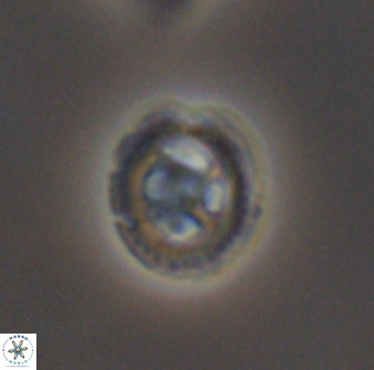 Grantarhabdus bukryi 8971