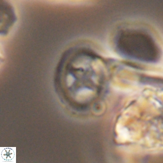 Grantarhabdus bukryi 9262
