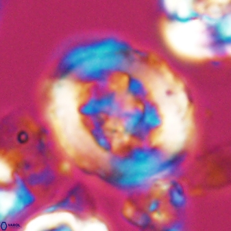 Grantarhabdus coronadventis 7822