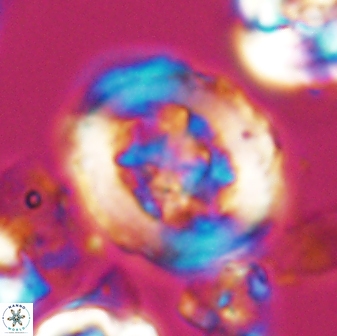 Grantarhabdus coronadventis 7822