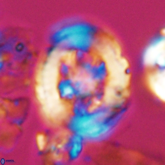 Grantarhabdus coronadventis 7824