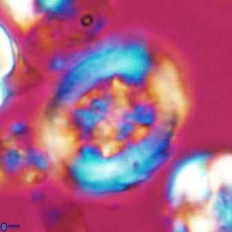 Grantarhabdus coronadventis 7826