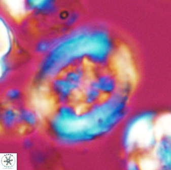 Grantarhabdus coronadventis 7826
