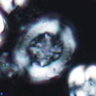 Grantarhabdus coronadventis 7827