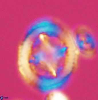 Grantarhabdus coronadventis 8284