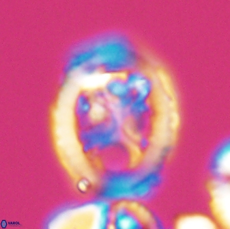 Grantarhabdus coronadventis 8593